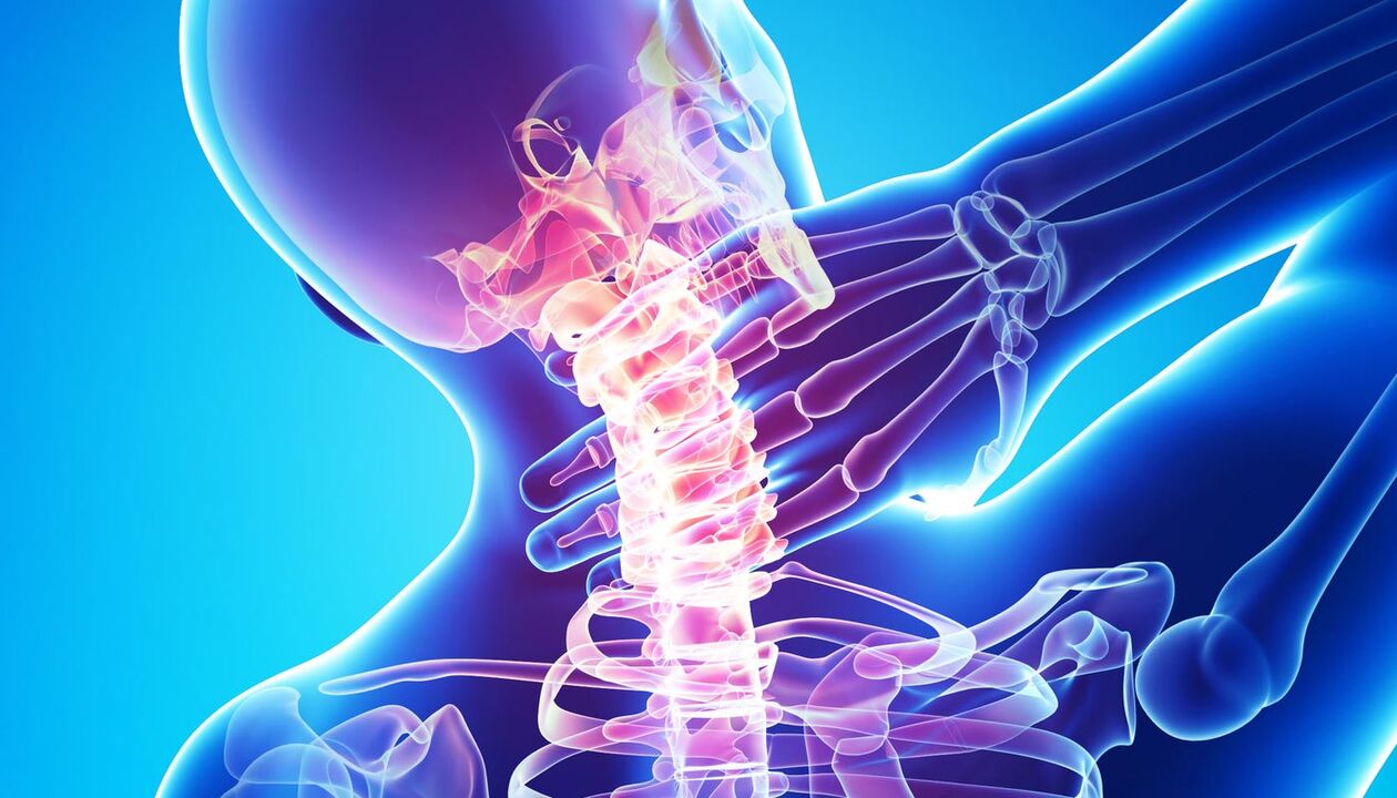 bolest krku v důsledku osteochondrózy